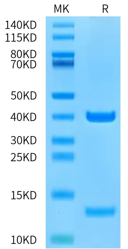 Bis-Tris PAGE Data