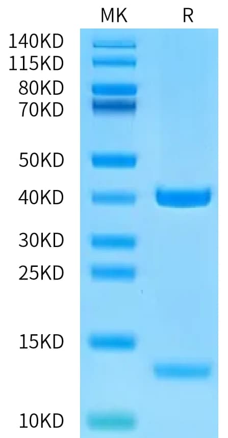 Bis-Tris PAGE Data