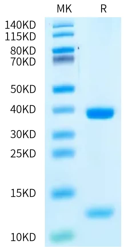 Bis-Tris PAGE Data