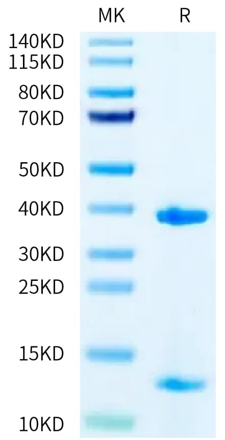 Bis-Tris PAGE Data
