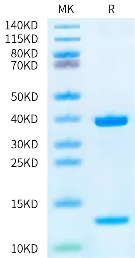 Bis-Tris PAGE Data