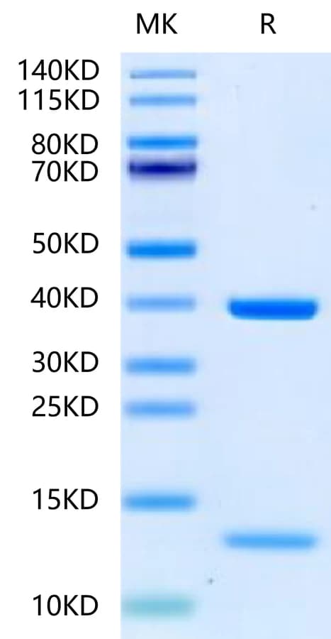 Bis-Tris PAGE Data
