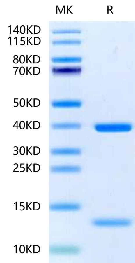 Bis-Tris PAGE Data