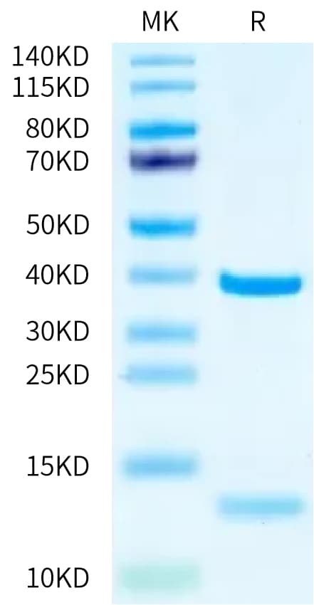 Bis-Tris PAGE Data