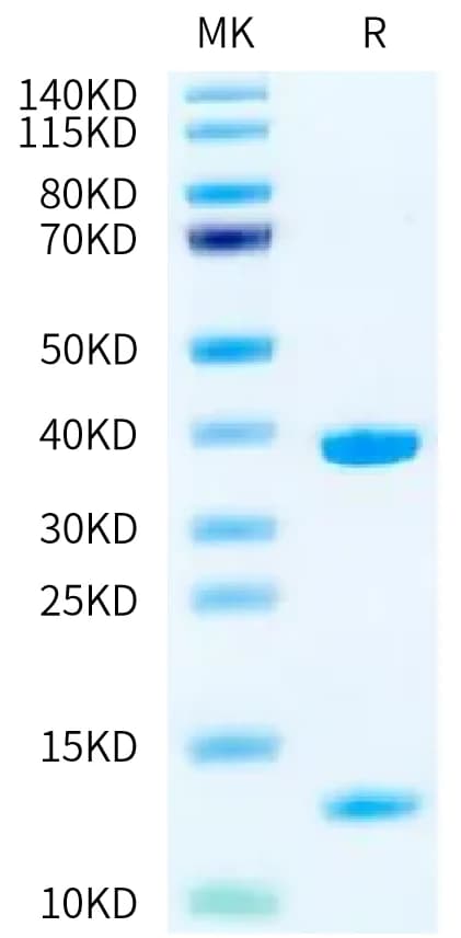 Bis-Tris PAGE Data