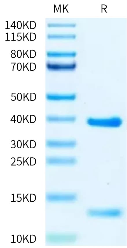 Bis-Tris PAGE Data
