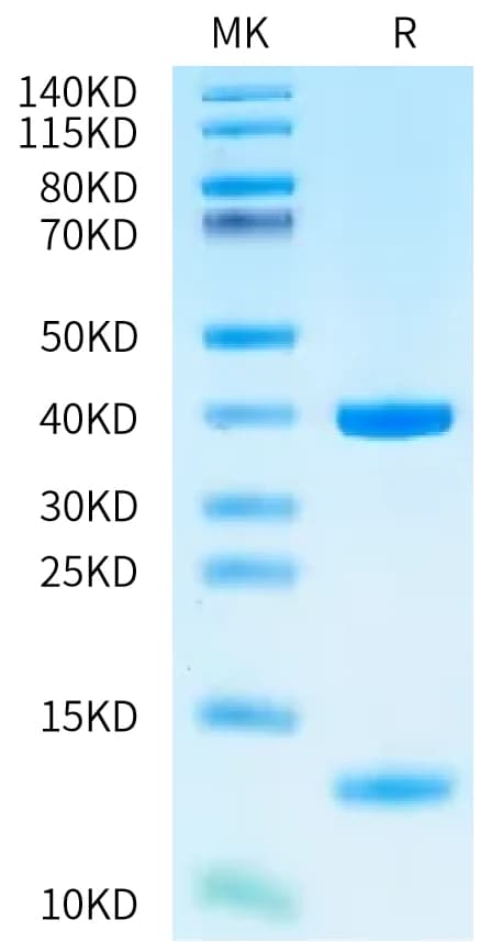 Bis-Tris PAGE Data