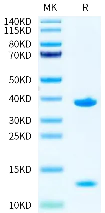 Bis-Tris PAGE Data