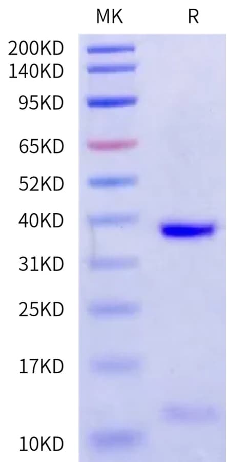 Bis-Tris PAGE Data