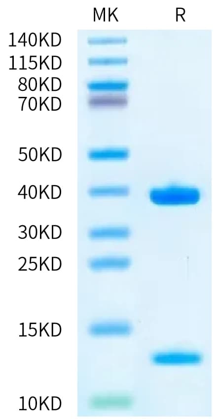 Bis-Tris PAGE Data