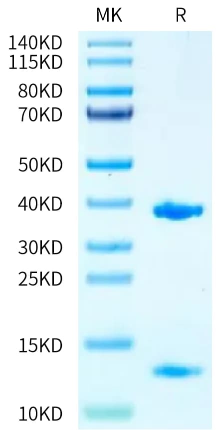 Bis-Tris PAGE Data