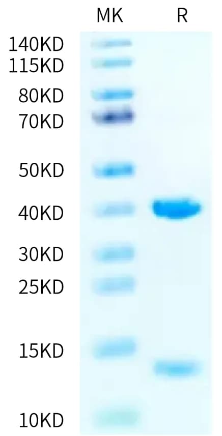 Bis-Tris PAGE Data