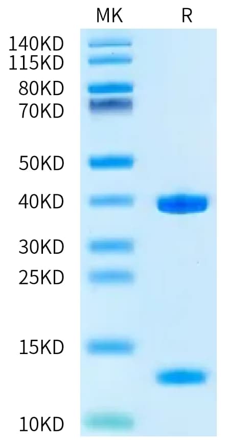 Bis-Tris PAGE Data