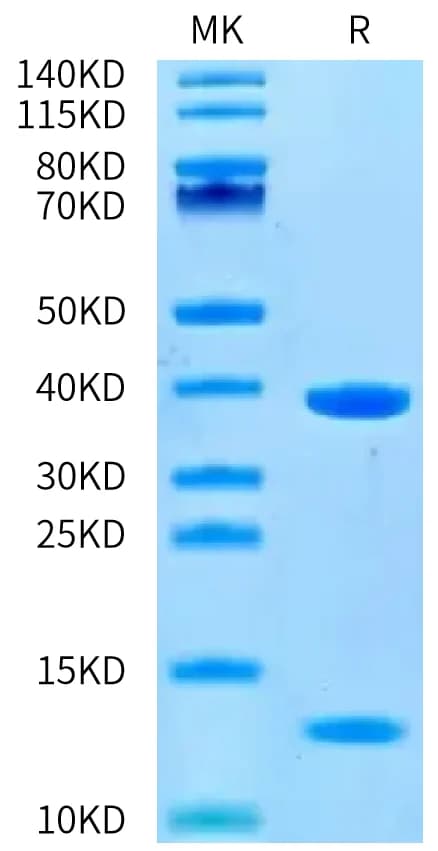 Bis-Tris PAGE Data
