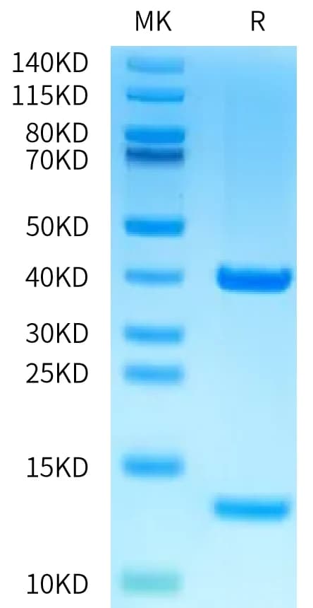 Bis-Tris PAGE Data