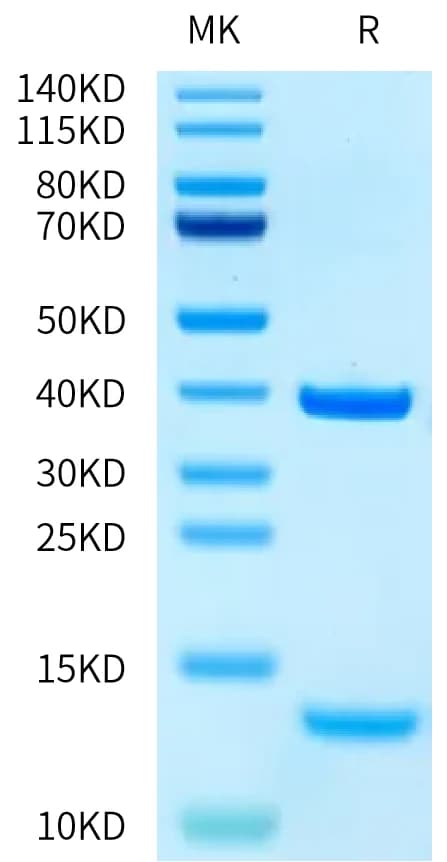 Bis-Tris PAGE Data