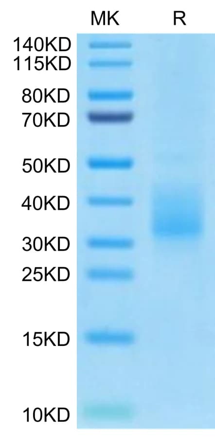 Bis-Tris PAGE Data