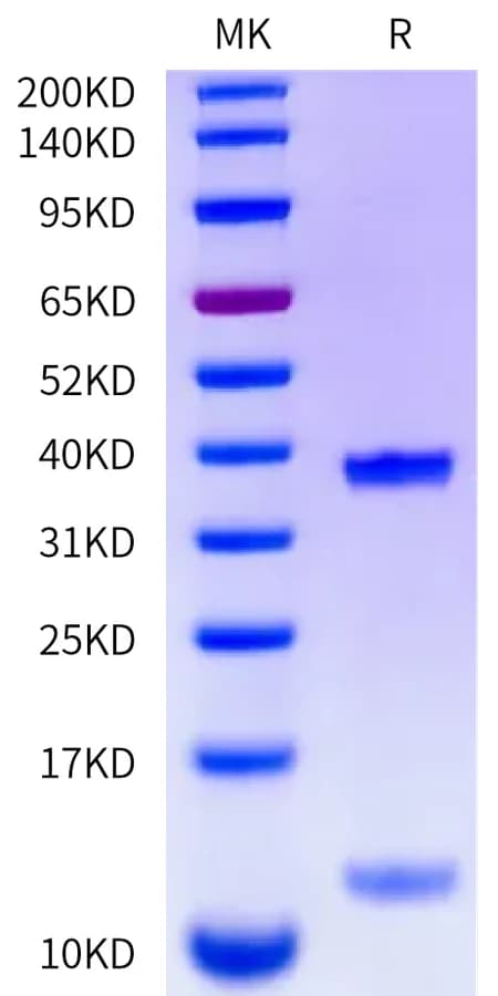 Bis-Tris PAGE Data