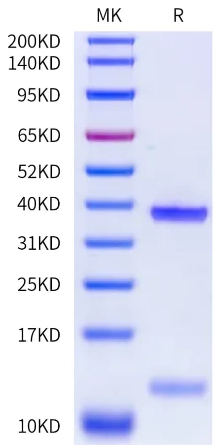 Bis-Tris PAGE Data