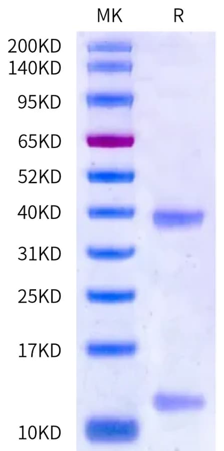 Bis-Tris PAGE Data