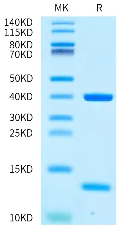 Bis-Tris PAGE Data