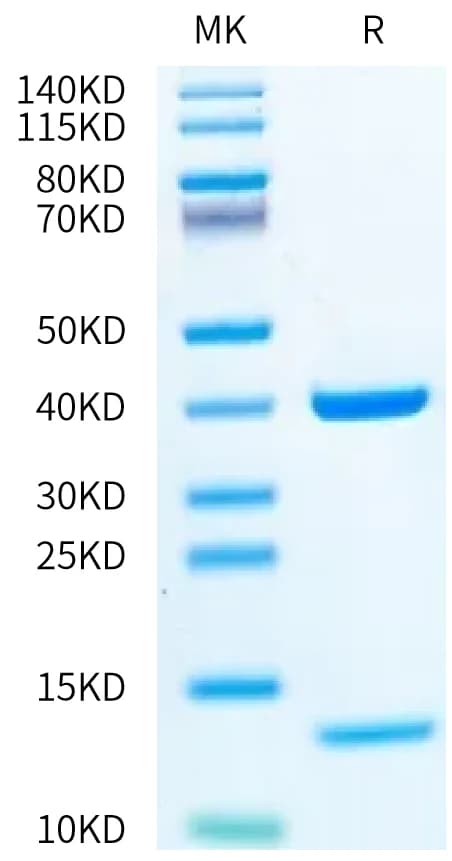 Bis-Tris PAGE Data