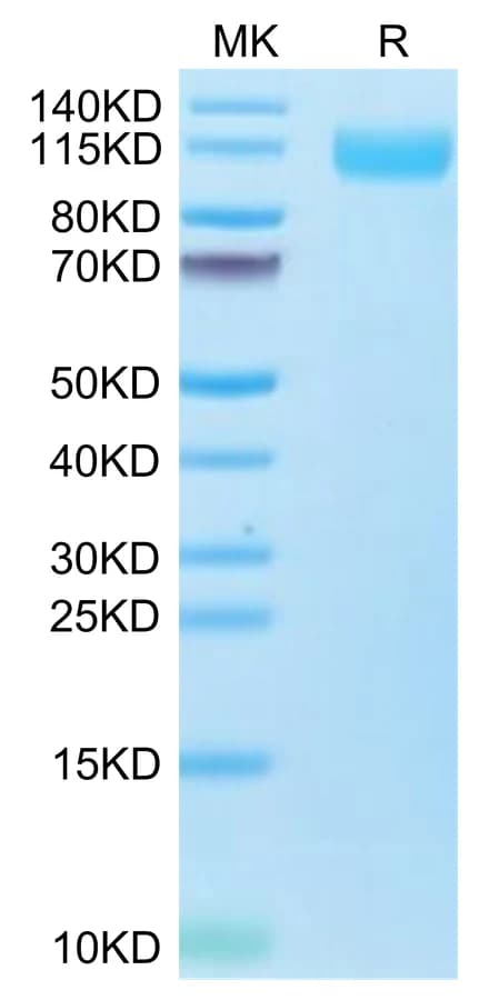 Bis-Tris PAGE Data