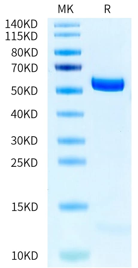 Bis-Tris PAGE Data