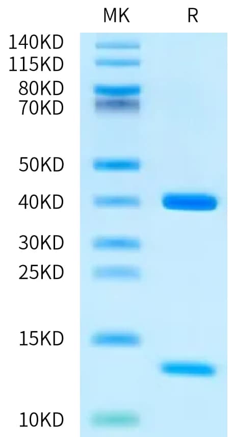 Bis-Tris PAGE Data